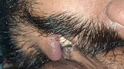 साली काटना चाहती है