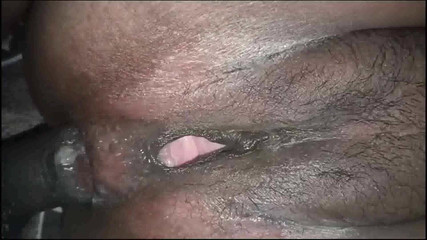 गलाट छेद 2