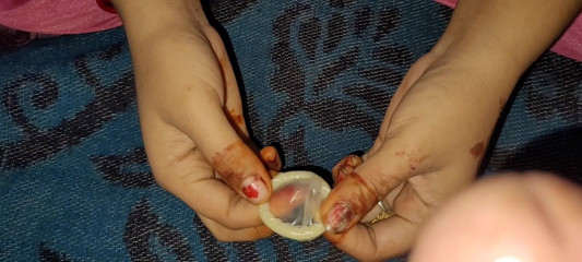 गुदा का प्रयास करें